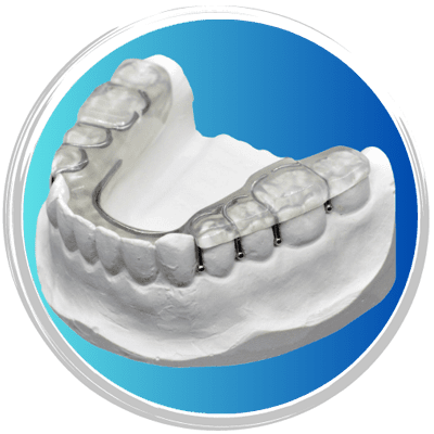Milled Splints - True Function Laboratory